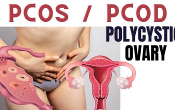 What is PCOD and PCOS Problem in Women-classiblogger uni updates